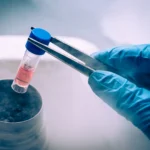 stem-cell-treatments-page